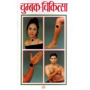 Chumbak Chikitsa (Hindi Edition)