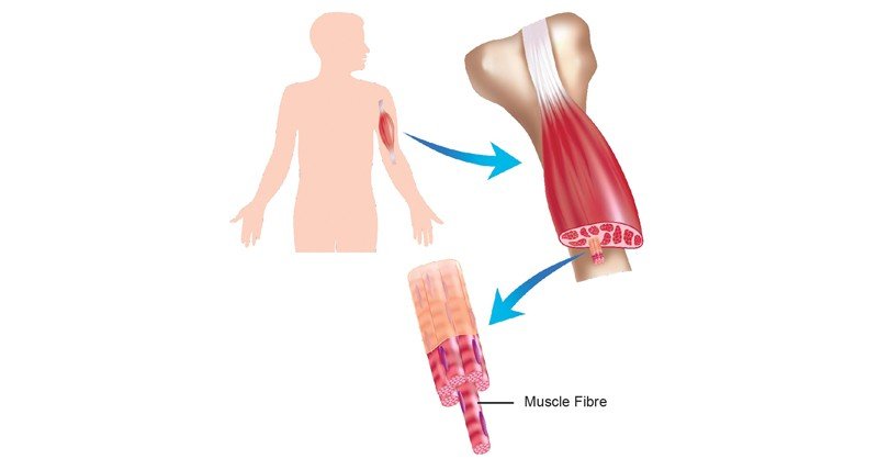 Skeletal-muscle