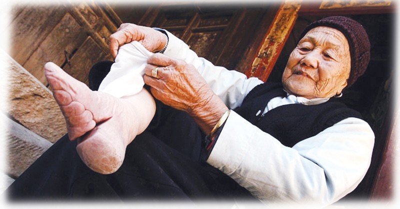 Foot-Binding
