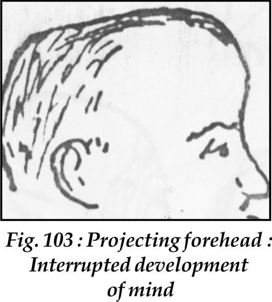 Foreheading Forehead - Sawan Books